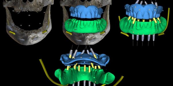 Comprehensive Guided Surgery Course- September 2024 - Image 4