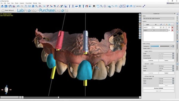 Comprehensive Guided Surgery Course- September 2024 - Image 3