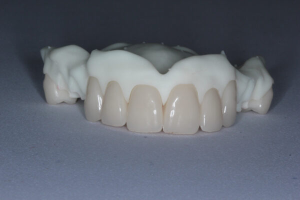 Digital Denture Course - March 2025 - Image 6