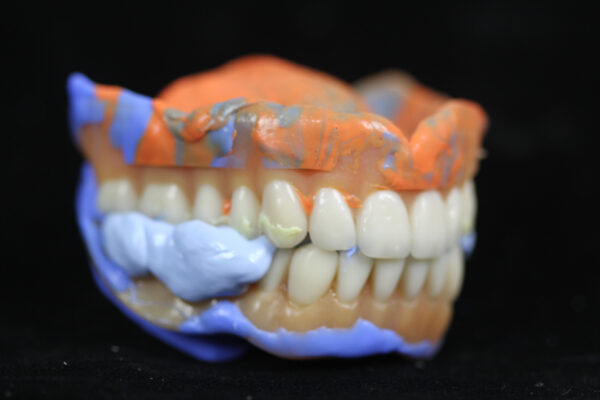 Digital Denture Course - March 2025 - Image 2